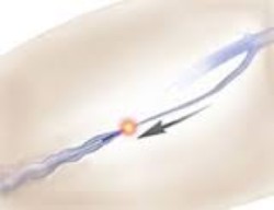 big 35153655 0 250 192